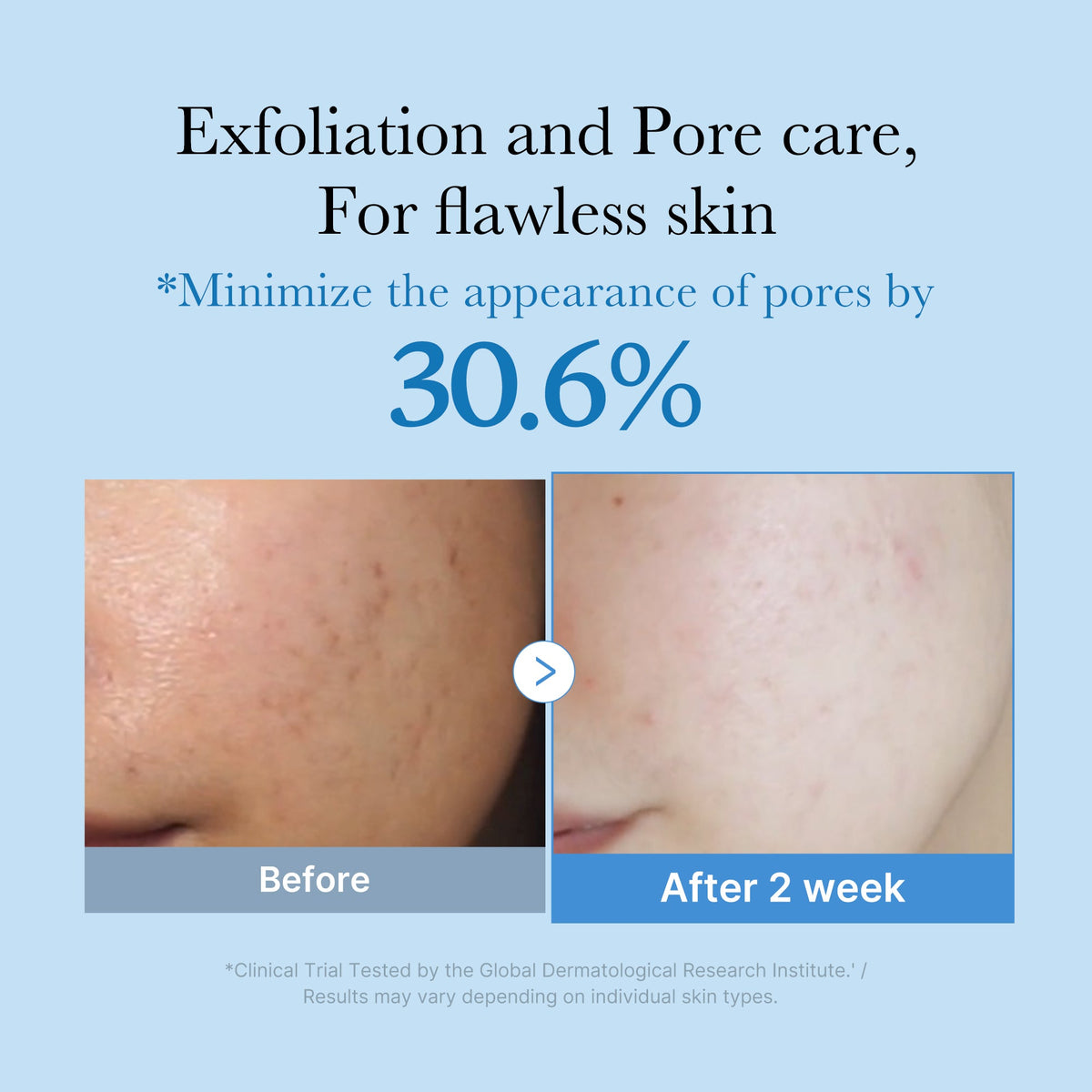 zero-pore-toner-v1 01_d6480b4e-3c08-4954-994a-ed5212c1839c.jpg
