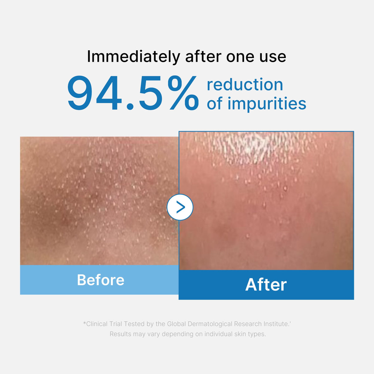 zero-pore-blackhead-deep-cleansing-oil-k7 01_eed557ec-5857-46a2-8b17-dbd67c692dcb.jpg