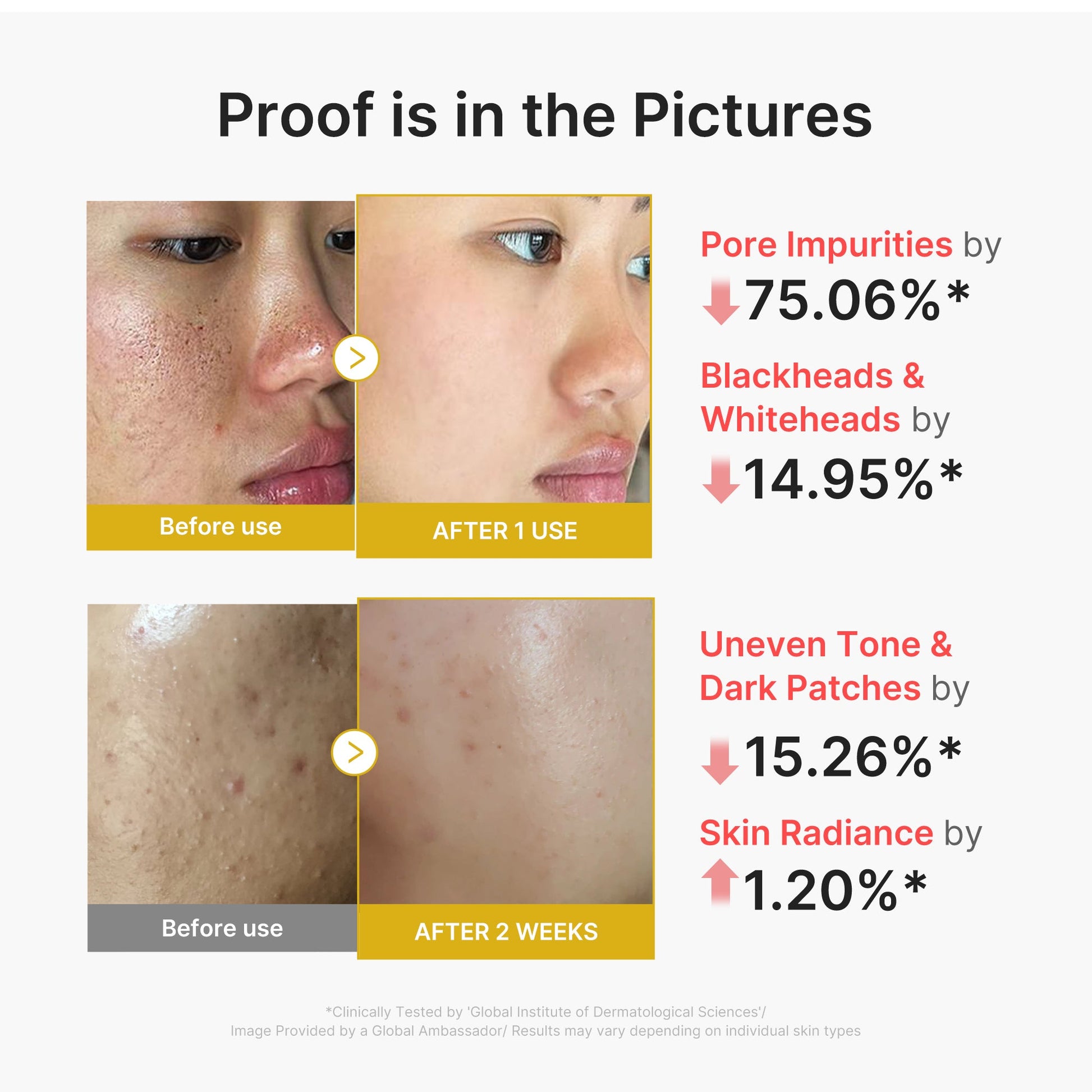 kojic-acid-turmeric-peel-shot-y4 02_45fe66d3-b3f6-4100-aa52-2afd7eded417.jpg