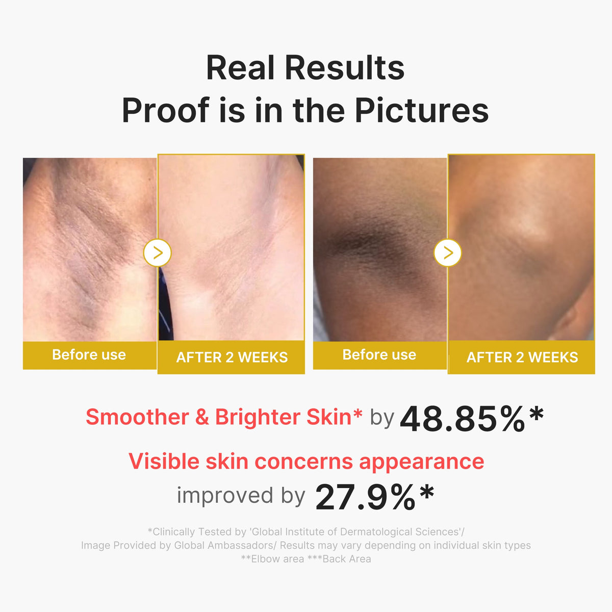 kojic-acid-turmeric-body-peel-shot-g5 02_72880cfc-382b-440b-8152-7e3dce87da2a.jpg