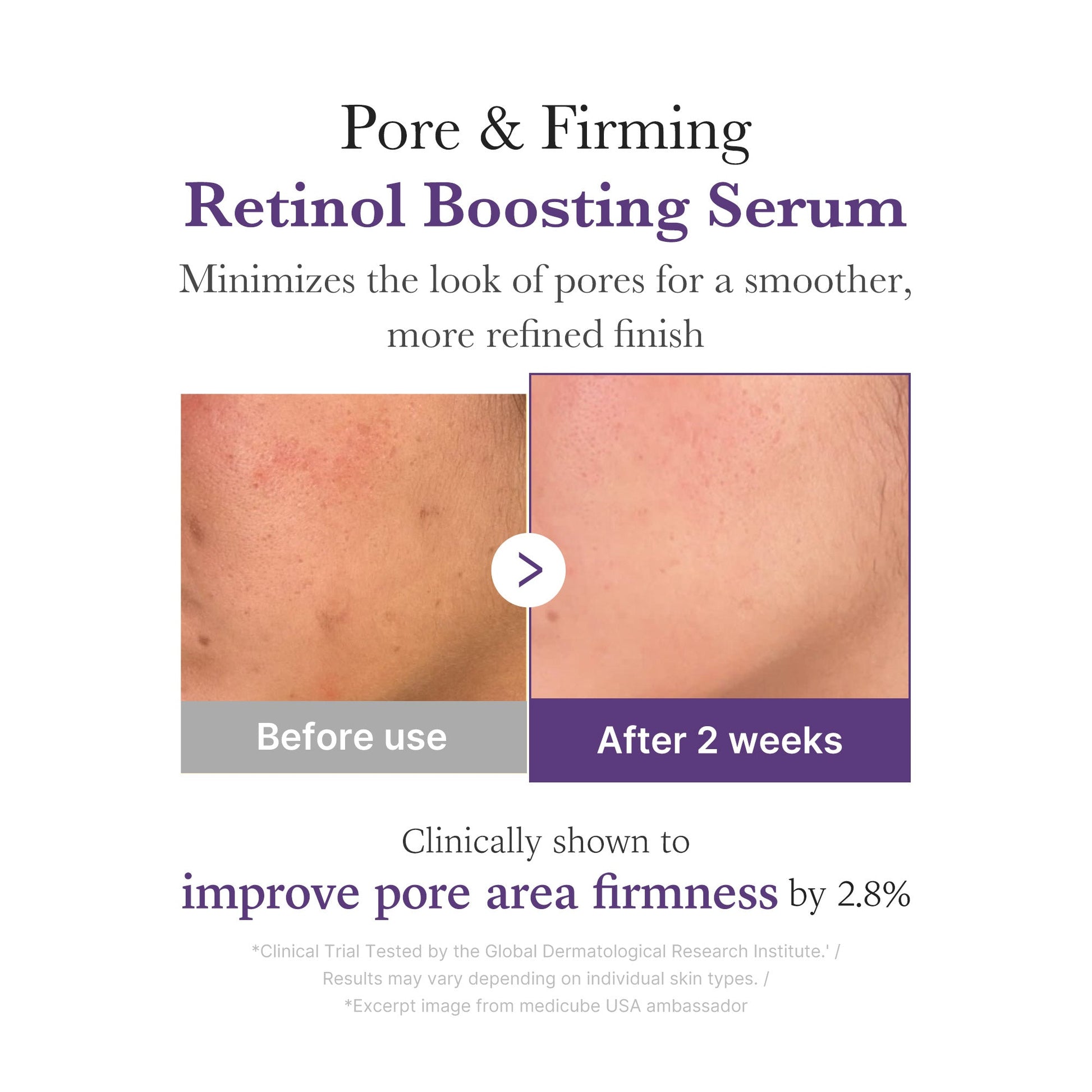 retinol-nmn-boosting-serum-n5 03_3510e7a5-5633-4a18-81ea-1389593bd517.jpg