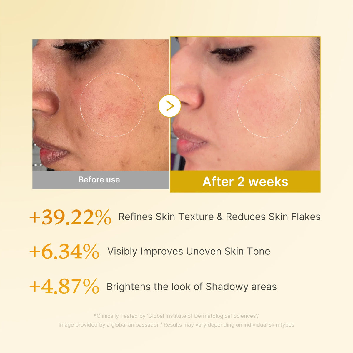kojic-acid-turmeric-toner-s1 03_b7578d52-4c93-4407-9c6c-7cb230c85b06.jpg