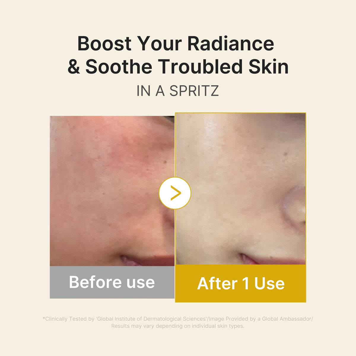 kojic-acid-turmeric-vitamin-gold-jelly-mist-serum-w6 03_dc9cd19e-4e57-49d3-9b66-c7762e8a63f1.jpg