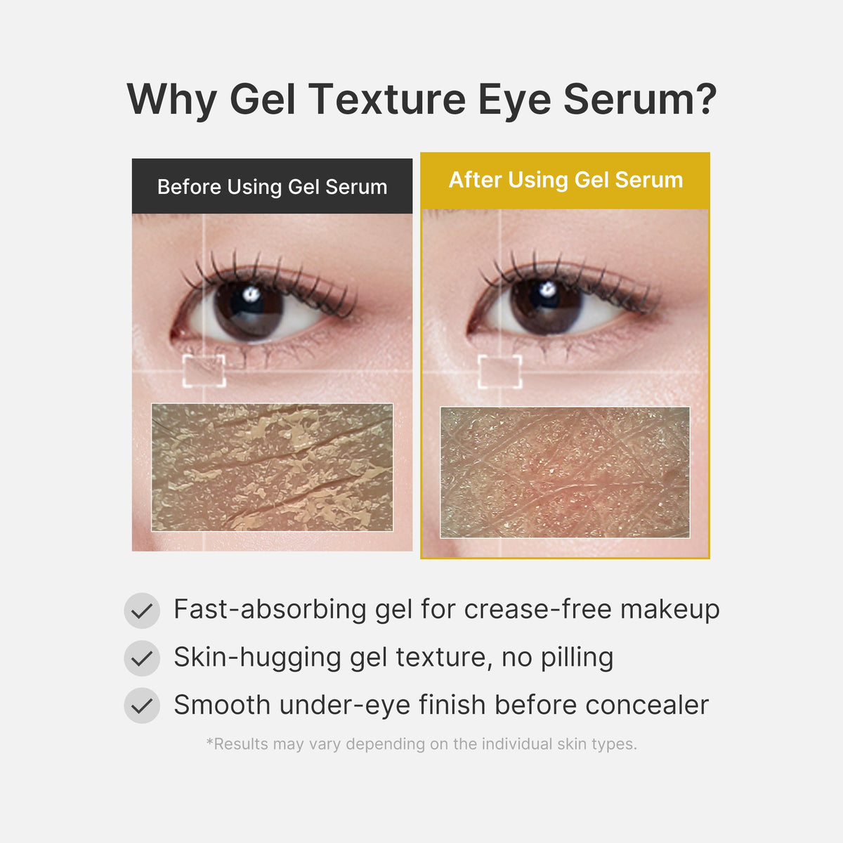 kojic-acid-tumeric-eye-gel-serum-t0 04_0487ef36-49f4-4294-8049-bb55118b05fe.jpg