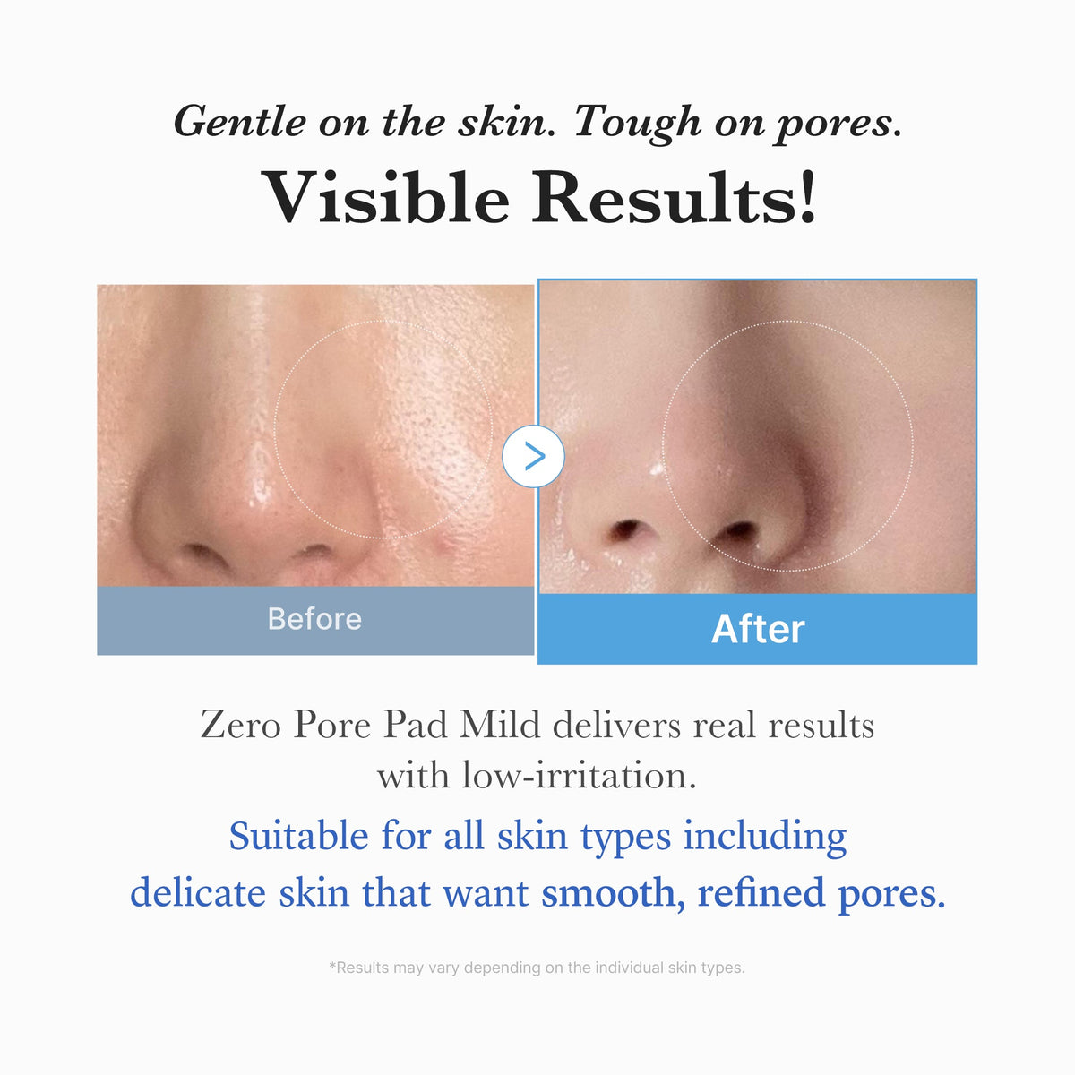 zero-pore-madecassoside-pads-mild-e2 04_6357f9f9-483b-4891-82c6-a58d336e62c8.jpg