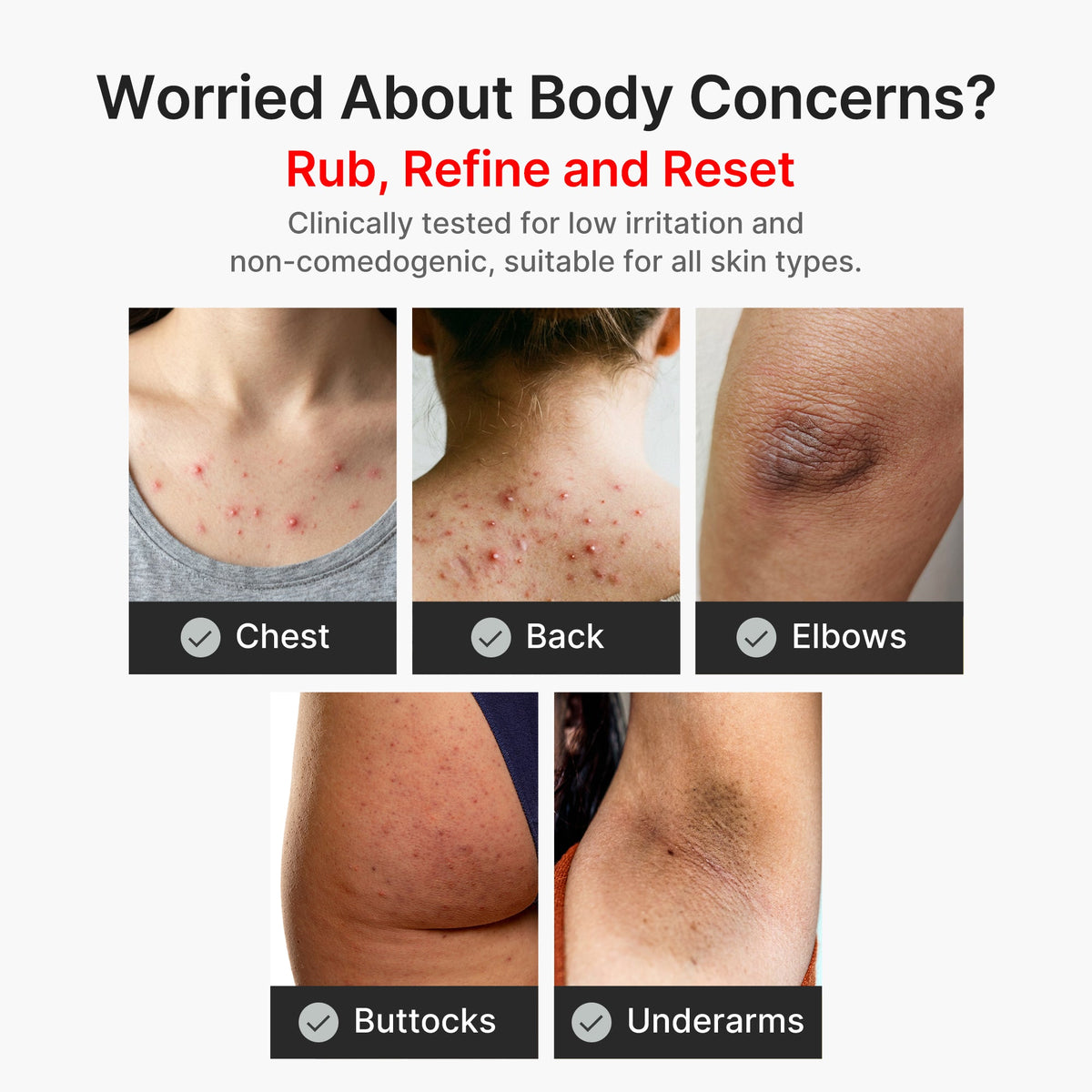 kojic-acid-turmeric-body-peel-shot-g5 04_8a7237f2-3ebf-401e-bd85-54841aeb3efc.jpg