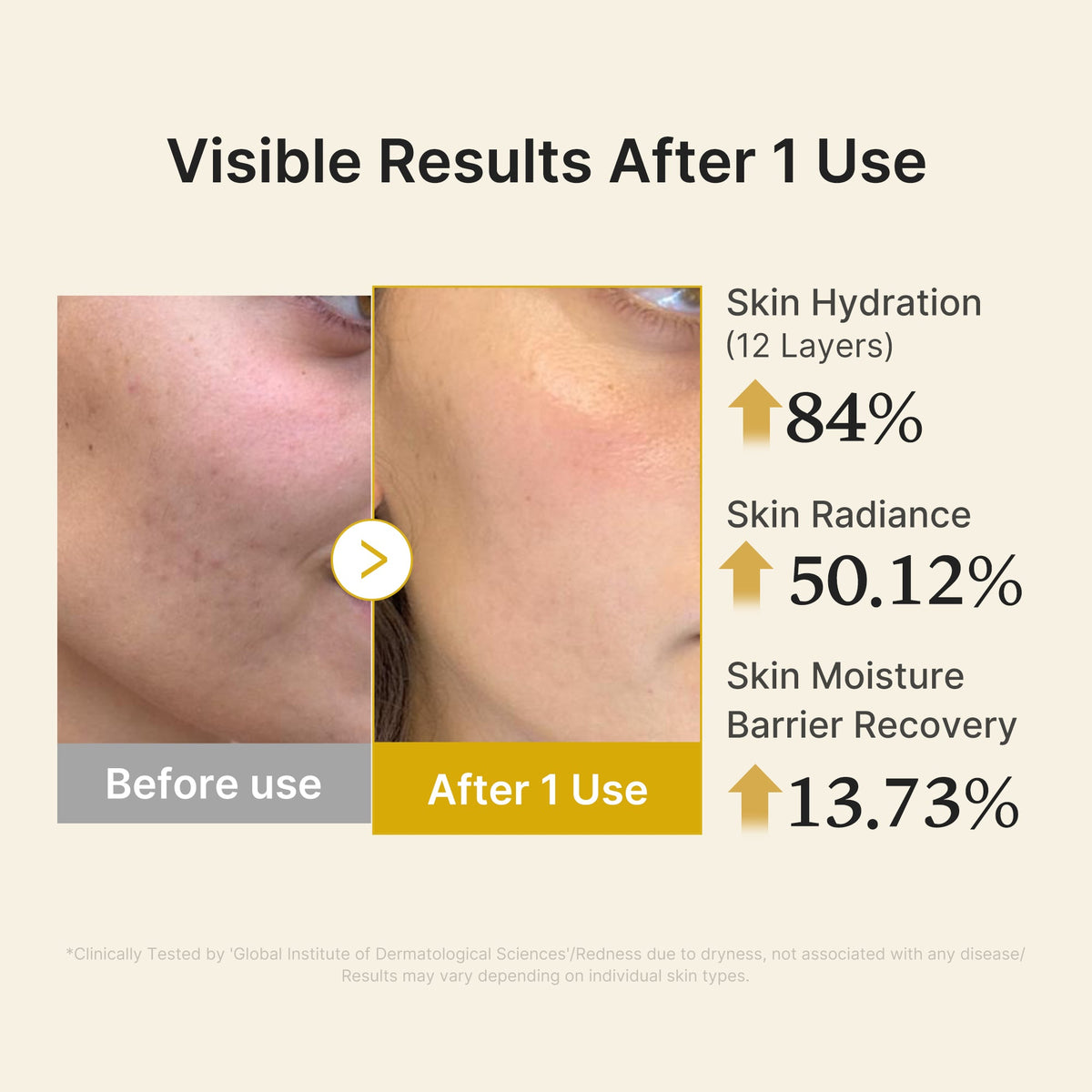 kojic-acid-turmeric-vitamin-gold-jelly-mist-serum-w6 04_d5c55ef1-e03b-494d-bc0d-a1ecc7fc2abf.jpg