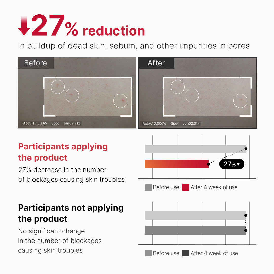 red-body-peeling-shot-cleanser-o9 07_60b5b2fd-b0f0-4cae-b358-5c38181e8dd8.jpg