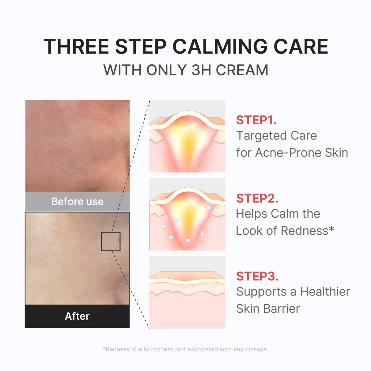 3h-daily-relief-cream-l3 3H_04.jpg