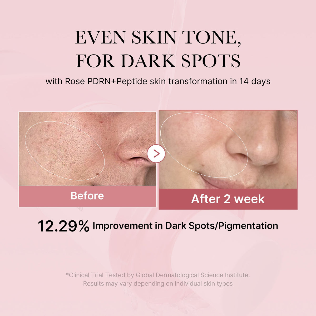 pdrn-pink-peptide-toner-w5 PDRN_01_308c518e-5ac6-4e54-99bd-eabc8796739b.jpg