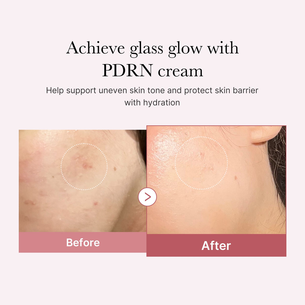 pdrn-pink-peptide-cream-h9 PDRN_02_d7805bfe-cf43-446a-b71b-a276683f136b.jpg