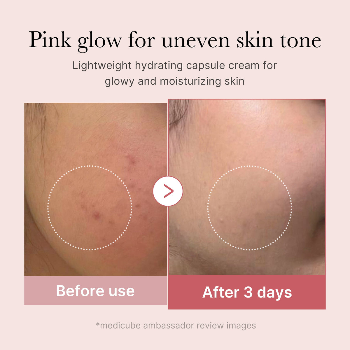 pdrn-pink-collagen-capsule-cream-l0 PDRN_03_058d09d8-4f44-4b1e-927c-e27b1738ae51.jpg