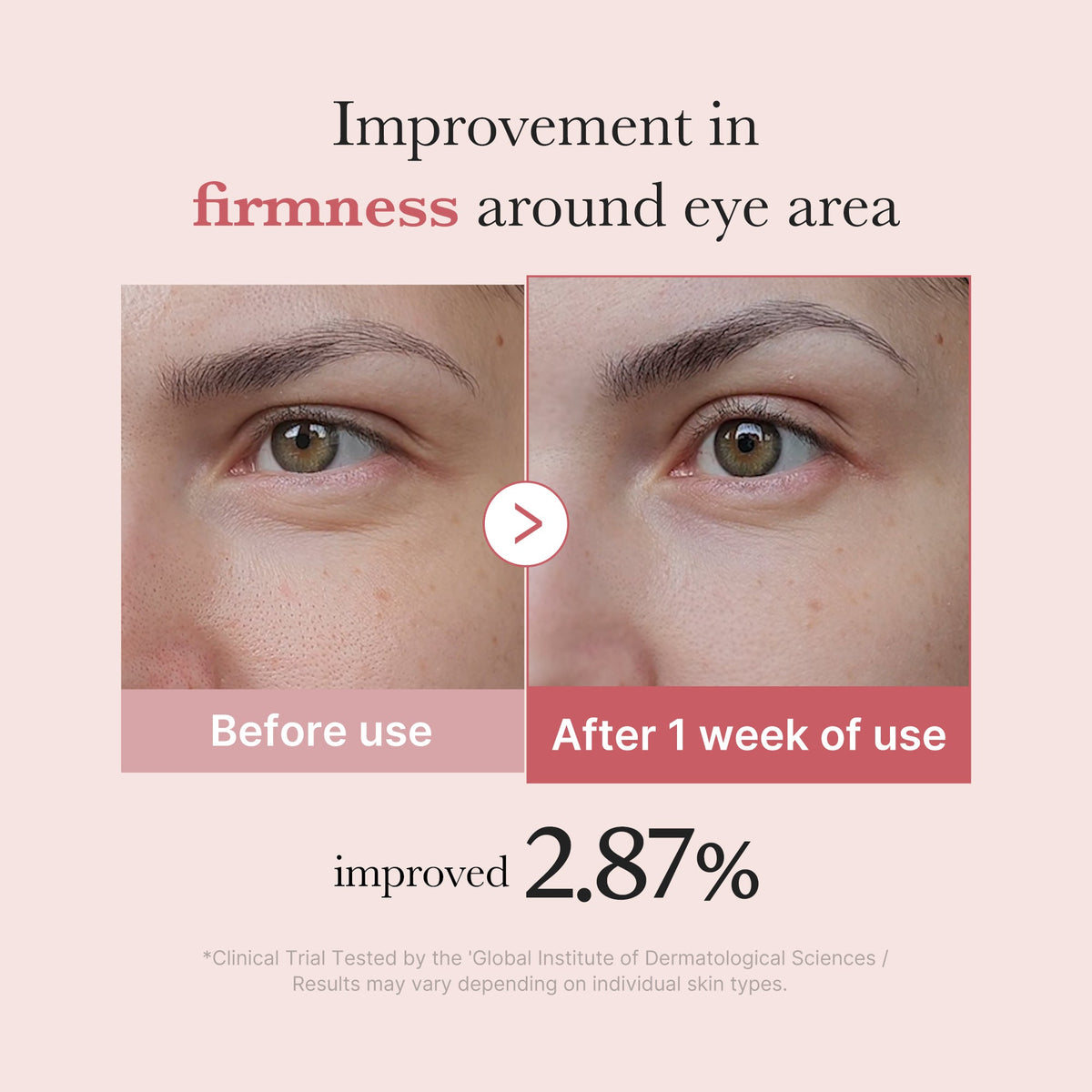 pdrn-pink-peptide-eye-cream-s8 PDRN_03_256dd753-0a2f-41b4-b3cd-bbfd3bc27018.jpg
