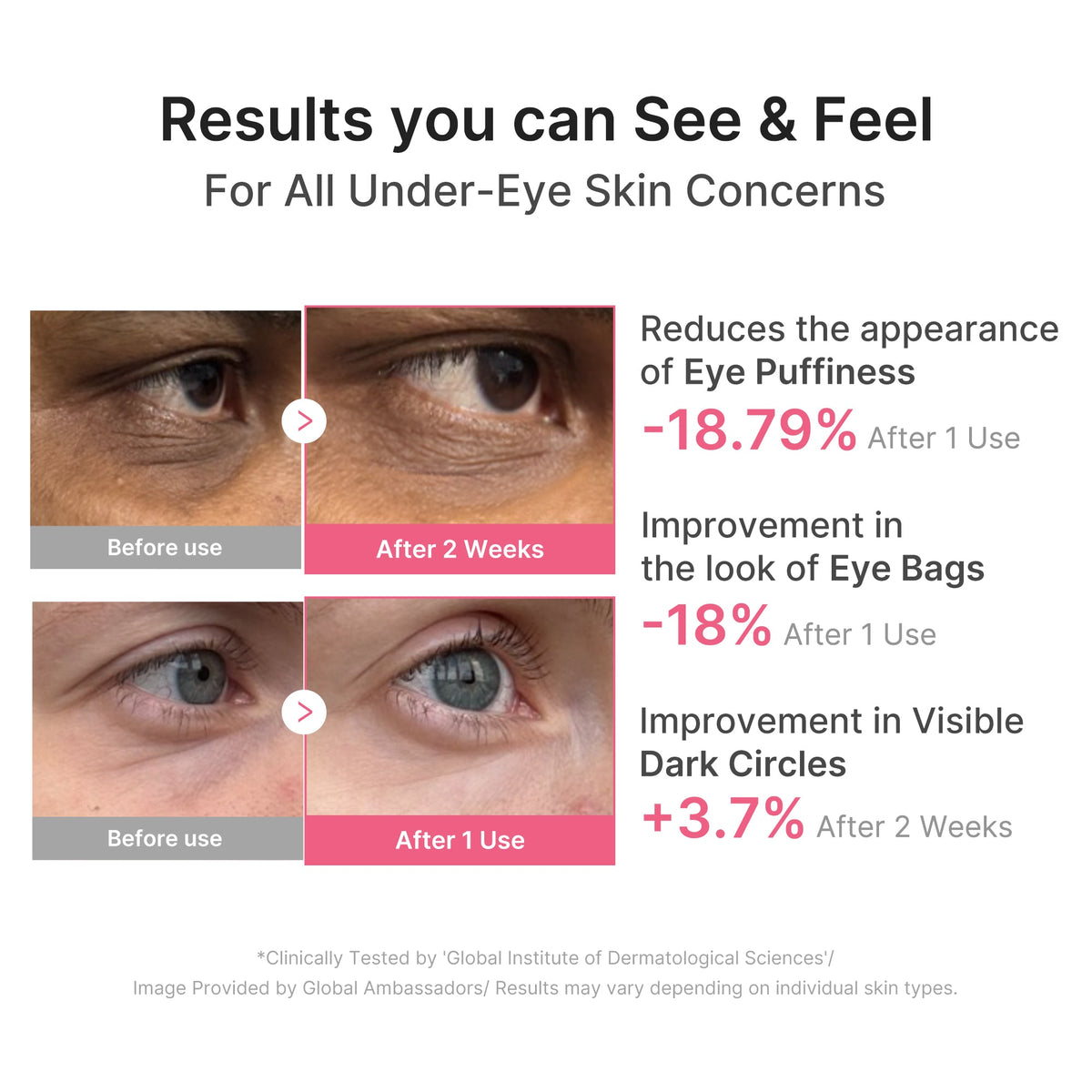 pdrn-caffeine-collagen-eye-patch-i1 PDRN_03_cdce2143-b8d8-43cb-ac69-fcbdf6640249.jpg