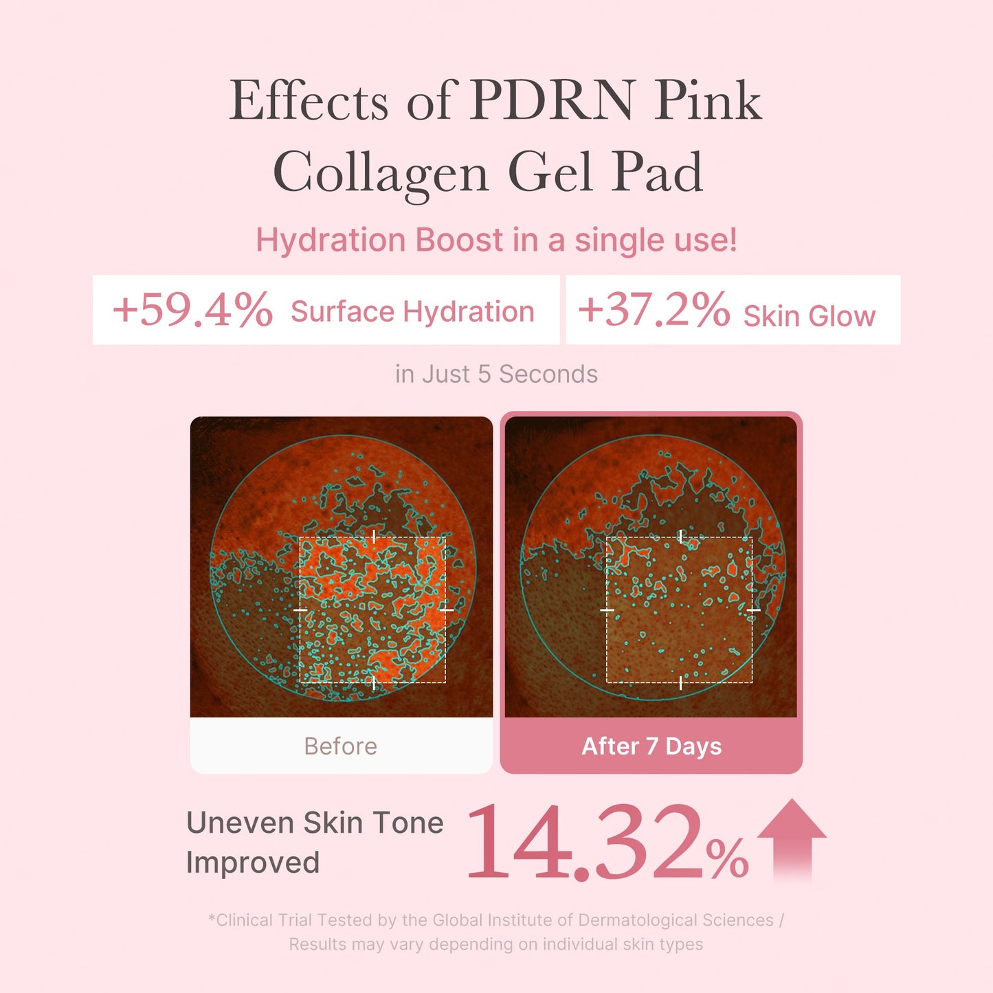 pdrn-pink-collagen-gel-toner-pad-k1 PDRN_04_f9a16a56-8d9e-4c47-a635-ed34ec3ed571.jpg