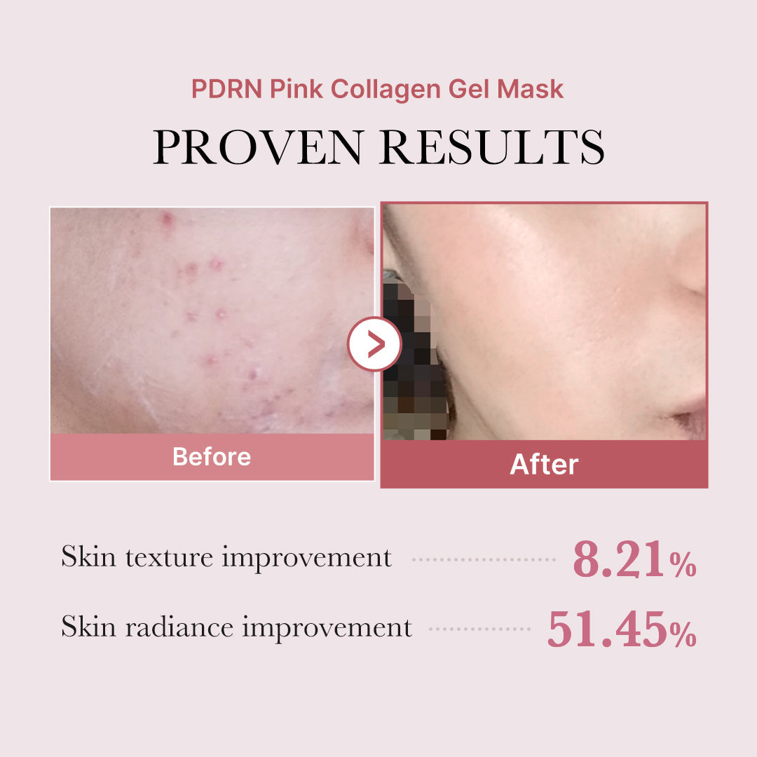 salmon-pdrn-pink-collagen-jelly-gel-mask-u6 PDRN_12.jpg