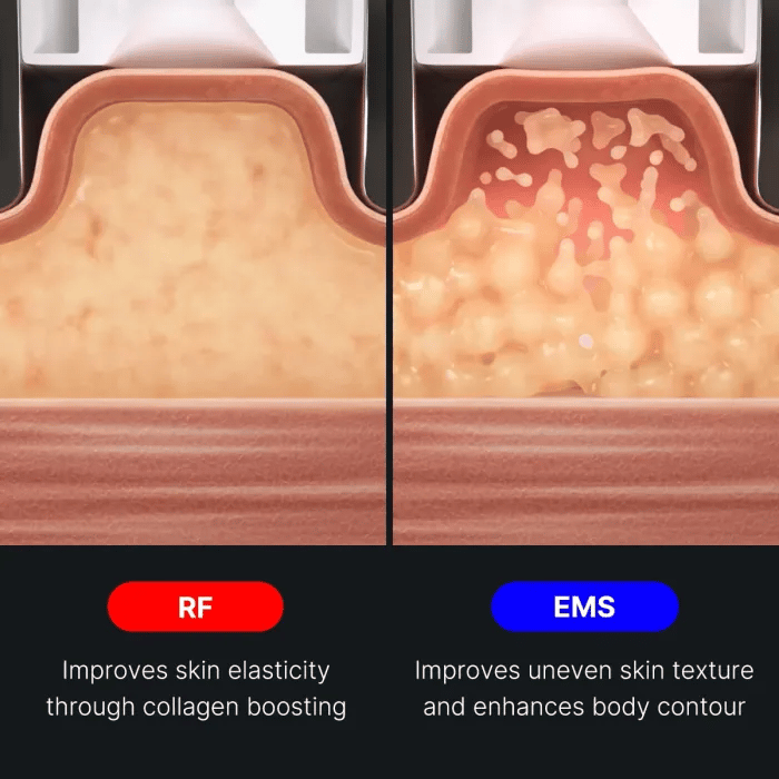 age-r-contour-body-shot-r5 img.webp